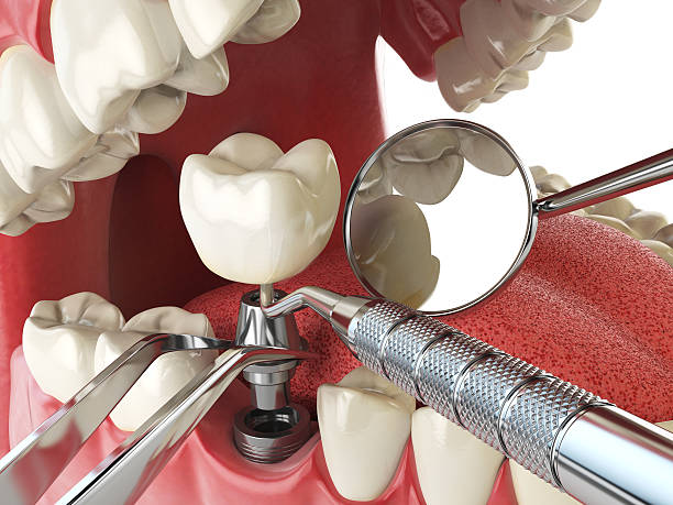 Best Emergency Tooth Extraction in Pinetops, NC