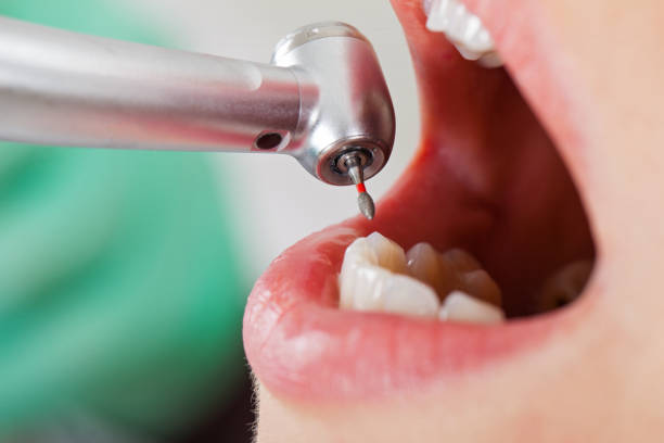 Best Weekend Emergency Dentist in Pinetops, NC